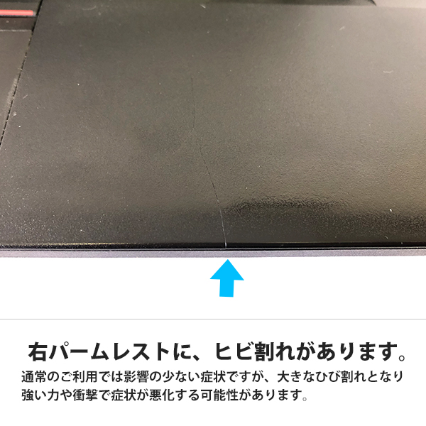 Lenovo 〔中古〕 ThinkPad L570 / インテル® Core™ i3 プロセッサー ...